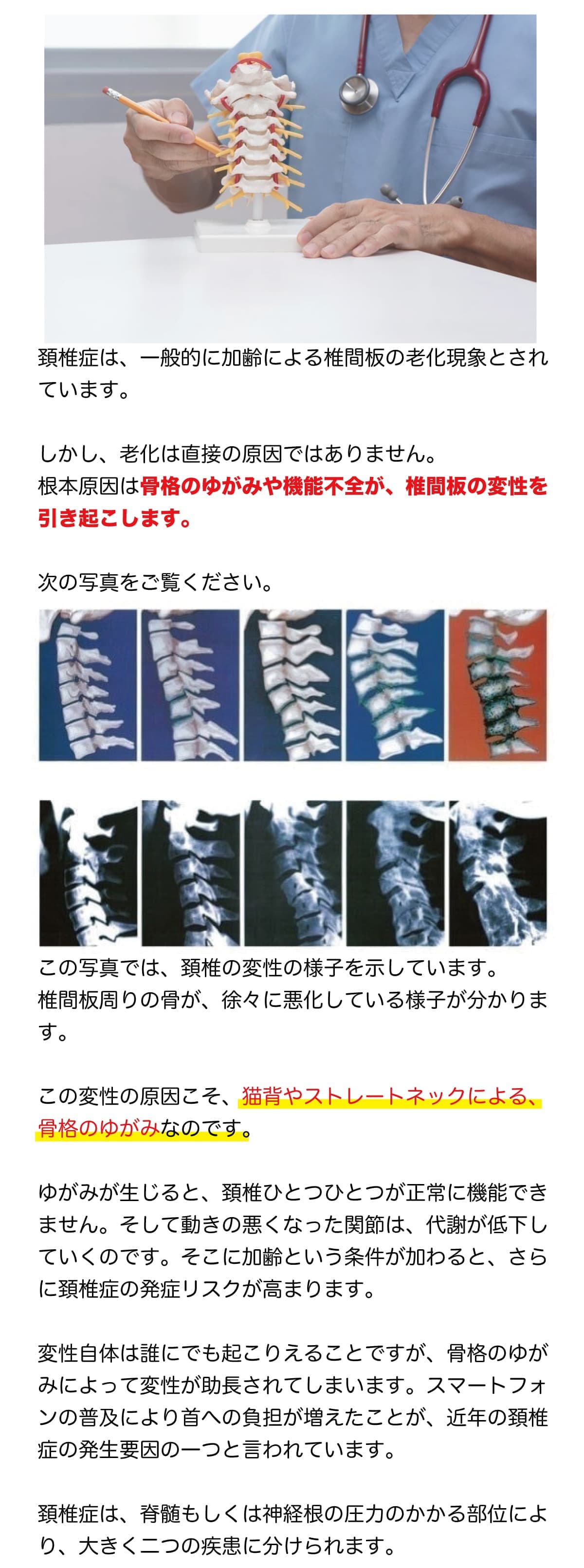 頚椎症はなぜ起こる？