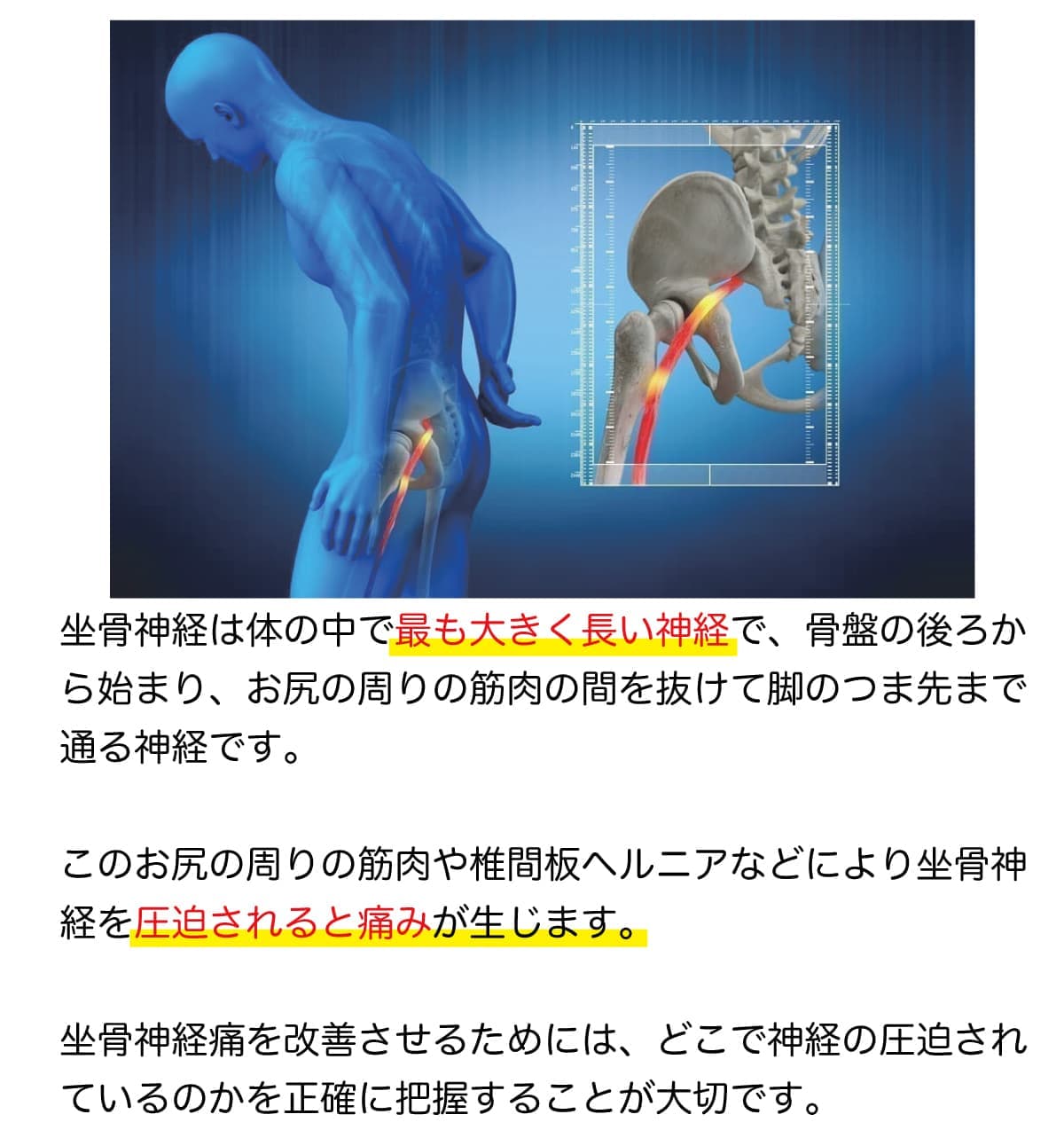 坐骨神経とは？