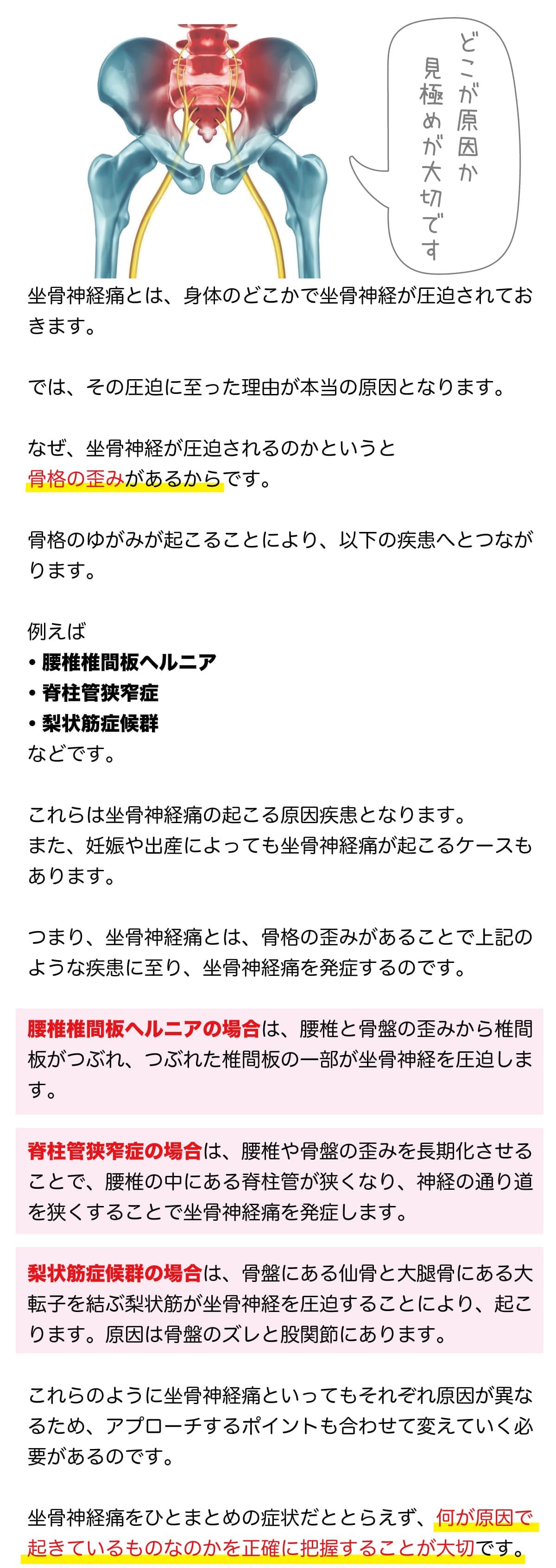 坐骨神経痛の原因