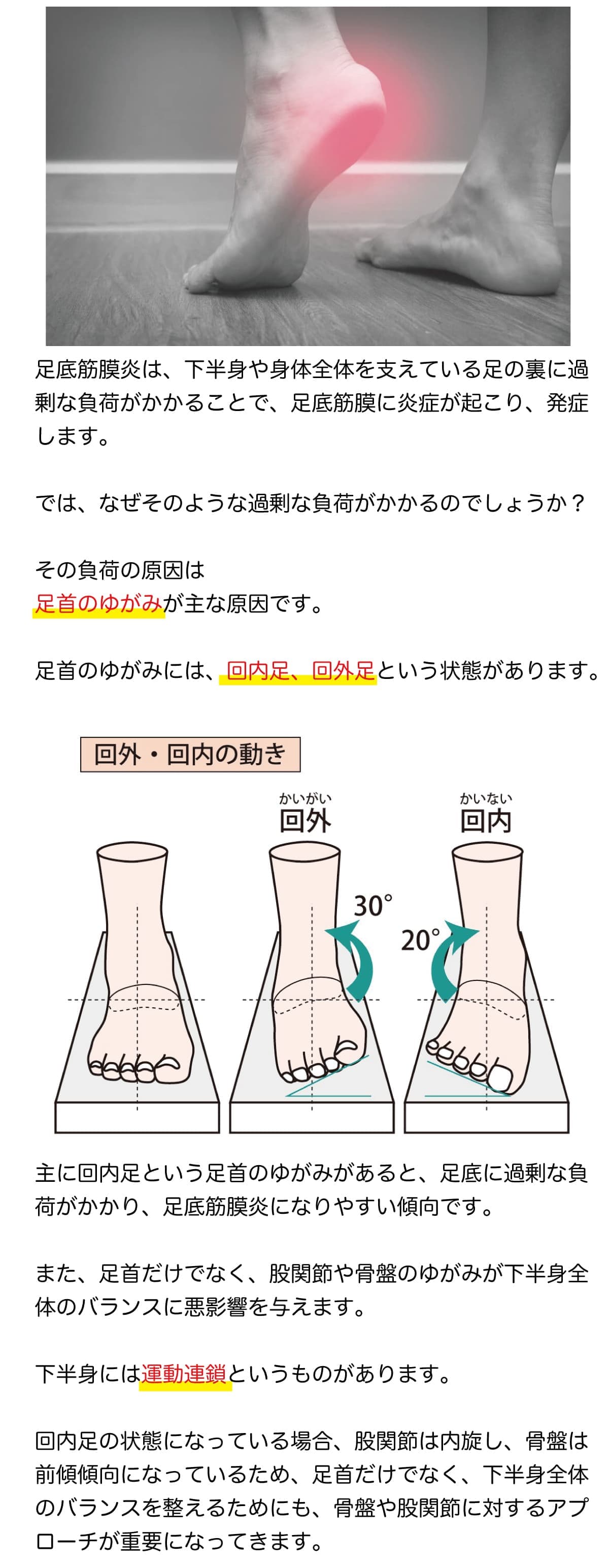 足底筋膜炎の原因